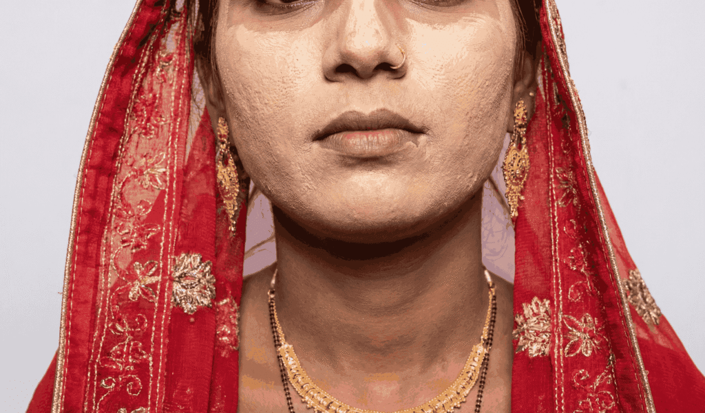 Side-angle shot of a bride showing visible foundation mismatch between face and neck.